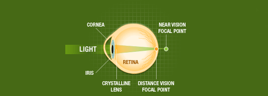 Presbyopia Chart